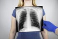X-ray of the chest of a woman. A doctor radiologist is studying an x-ray examination. A picture of the organs of the chest cavity