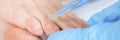 Doctor removes callus with scalpel. Podiatry medical services
