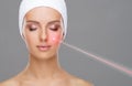 Doctor removing moles using laser ray. Beauty portrait of a young woman. Birthmark removal, plastic surgery, skin