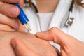 Doctor removing a tick with tweezers from hand of patient Royalty Free Stock Photo