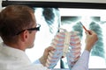Doctor with ribs and lungs model pointing at x-ray image