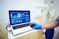doctor`s hand in blue gloves holds a mouse on a laptop with the image of dental x-ray