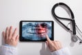 Doctor`s Hand And Digital Tablet Screen Showing Teeth X-ray