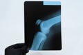 Doctor`s hand in glove holds an x-ray of the knee Royalty Free Stock Photo