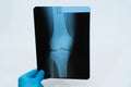 Doctor`s hand in glove holds an x-ray of the knee Royalty Free Stock Photo