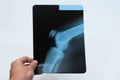 Doctor`s hand holds a knee x-ray Royalty Free Stock Photo