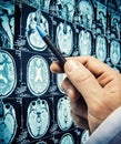 Doctor`s hand pointing the human brain in a magnetic resonance therapy mri image. Medical computed tomography background