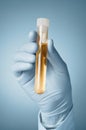 Doctor's hand with urine sample Royalty Free Stock Photo