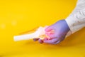 Doctor`s hands gluing a medical plaster on a model of a sore knee joint, yellow background. Knee pain concept, synovitis and