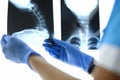 Doctor`s hands holding X-rays of cervical spine.