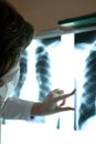 In the doctor`s office - lung radiography