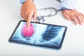 Doctor or scientist points to the results of lung check up from x-ray scan chest on tablet screen to patient. Lung Cancer,