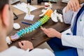 Doctor show polyaxial screw on the spine model. Spine fixation systems