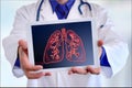 Doctor showing lungs on a tablet in front closeup