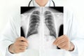 Doctor showing x-ray image of normal man chest Royalty Free Stock Photo