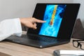 Doctor showing a x-ray of pain in the spine. Backache trauma Royalty Free Stock Photo