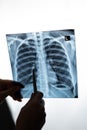 Doctor showing x-ray of patient& x27;s lungs. Royalty Free Stock Photo