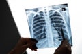 Doctor showing x-ray of patient's lungs. Royalty Free Stock Photo