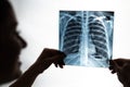 Doctor showing x-ray of patient& x27;s lungs. Royalty Free Stock Photo