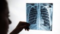 Doctor showing x-ray of patient's lungs. Royalty Free Stock Photo