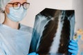 Doctor specialist pulmonary medicine holding radiological, chest x-ray film for medical diagnosis on patient health on infected Royalty Free Stock Photo