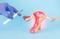 Doctor surgeon holds a surgical scalpel against the background of the layout of the female reproductive system. Concept of vaginal