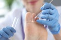 Doctor treating patients toes in clinic closeup Royalty Free Stock Photo