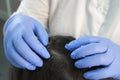 Doctor trichologist is examining woman skin on head in clinic, closeup view.