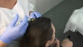 Doctor trichologist makes injections in woman`s skin on head for hair growth.