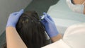 Doctor trichologist makes injections in woman`s skin on head for hair growth.