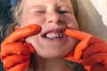 The doctor is trying to see the mouth of a little girl with an orthodontic appliance and crooked teeth Royalty Free Stock Photo