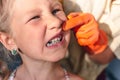 The doctor is trying to see the mouth of a little girl with an orthodontic appliance and crooked teeth Royalty Free Stock Photo