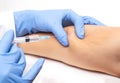 The doctor uses a syringe to take a skin biopsy from the patient. The concept of malignant subcutaneous lesions, close