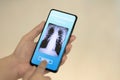 Doctor using smartphone for checking patient chest X-ray Royalty Free Stock Photo