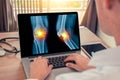 Doctor watching a laptop with x-ray of legs with pain in the knee. Radiology concept Royalty Free Stock Photo