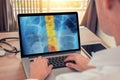 Doctor watching a x-ray of chest with pain in the spine. Radiology concept Royalty Free Stock Photo