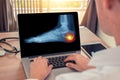 Doctor watching a x-ray of pain in the heel of a foot. Radiology concept