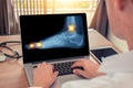 Doctor watching a x-ray of pain in the toe and the ankle of a foot. Radiology concept Royalty Free Stock Photo