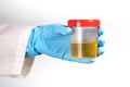 A doctor in a white coat and blue gloves holds a plastic can of urine in hand. urine tests virus, pregnancy, diseases