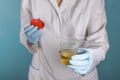 A doctor in a white coat and blue gloves holds a plastic can of urine in hand. urine tests virus, pregnancy, diseases