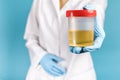 A doctor in a white coat and blue gloves holds a plastic can of urine in hand. urine tests virus, pregnancy, diseases