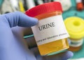 Doctor working with urine samples in a clinical laboratory