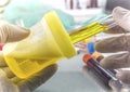 Doctor Working With Urine Samples In A Clinical Laboratory