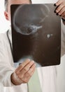 Doctor With X-Ray Royalty Free Stock Photo