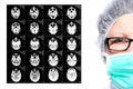 Doctor and X-ray picture of human head brain Royalty Free Stock Photo