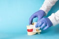 Doctor& x27;s hands glue a medical plaster on the mockup of the intervertebral disc, blue background. Spine Disease Therapy Royalty Free Stock Photo