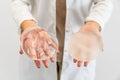 Doctor's hands holding two different types of breast prostheses.