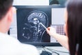 Doctors consider and discuss magnetic resonance image MRI of the brain. Back view, selective focus Royalty Free Stock Photo