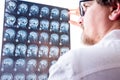 Doctors evaluation results of magnetic resonance imaging of brain in hospital concept photo. Neurologist in glasses keeps hand on Royalty Free Stock Photo