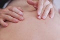 Doctors hand perform medical professional acupuncture treatment in beauty spa on mans body